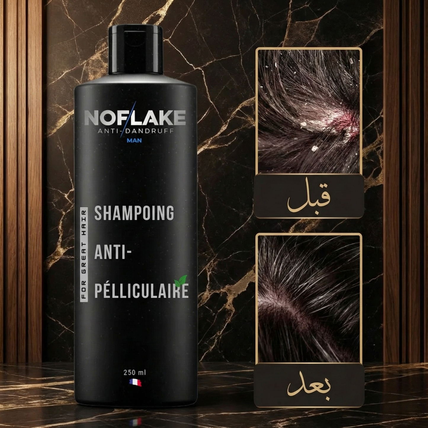 شامبو ضد القشرة