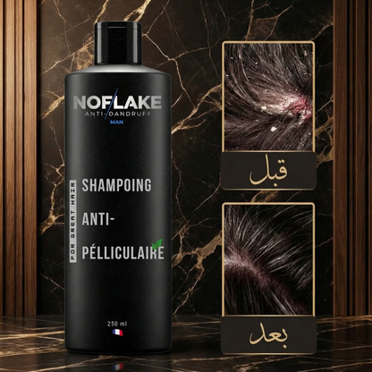 شامبو ضد القشرة