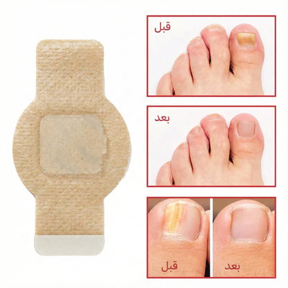 لاصيقات الأظافر العلاجية: سرّك الصغير لضفير صحية ونضيفة