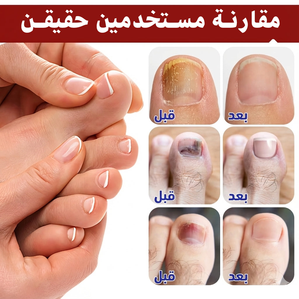 لاصيقات الأظافر العلاجية: سرّك الصغير لضفير صحية ونضيفة